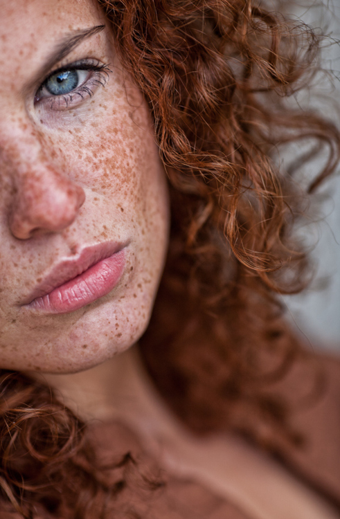 Red Headed freckles